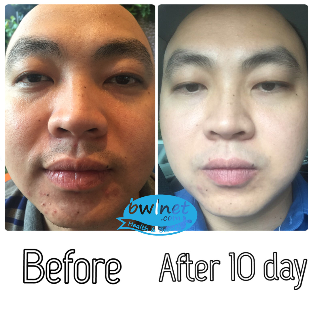 bwlnet-testimoni-tommy bwLnet.com